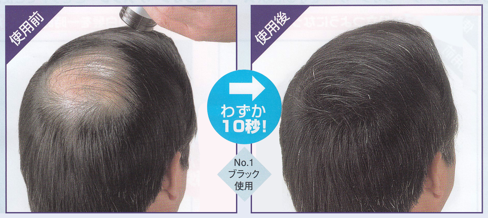 スーパーミリオンヘアー