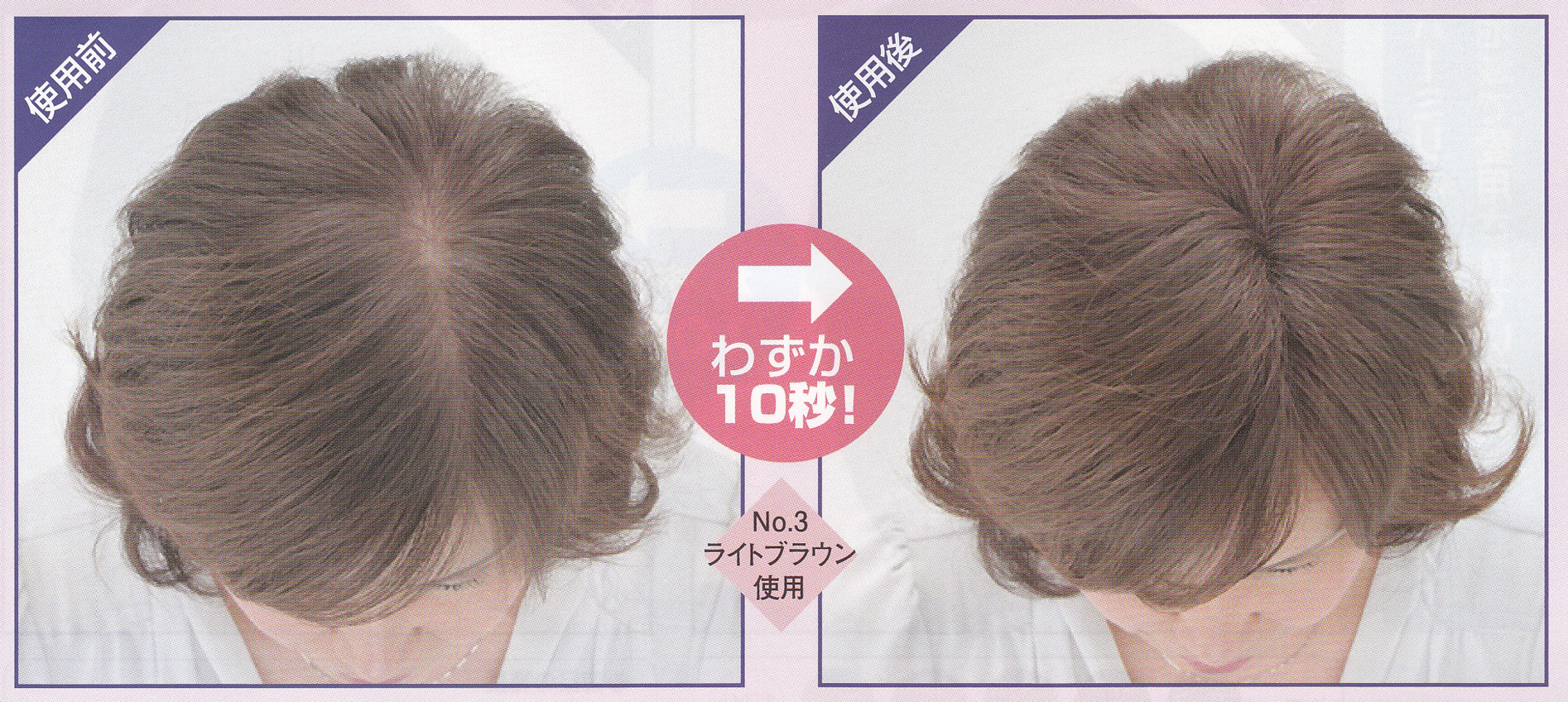 スーパーミリオンヘアー レディース